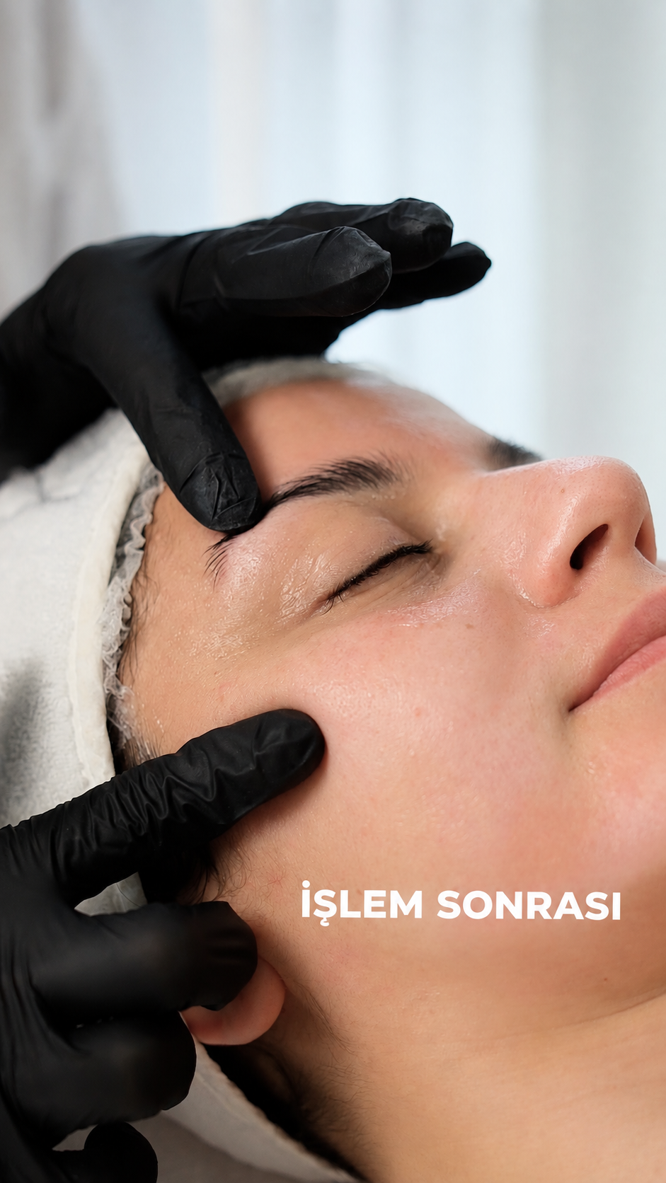 Sonrası Durumu